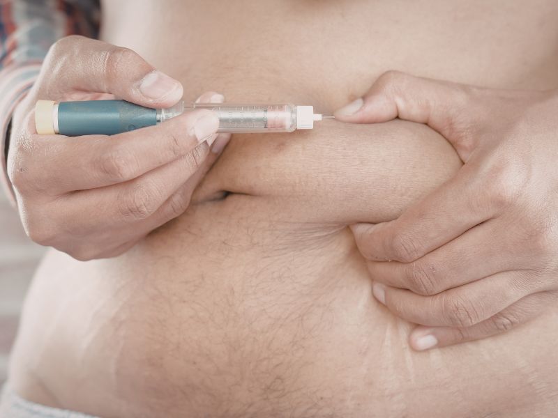 Béo phì do nội tiết tố một phần đến từ việc Insulin tăng cao