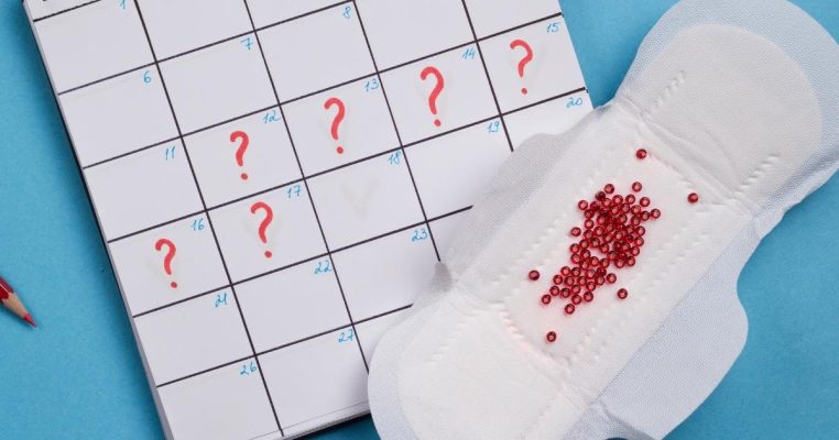 Kinh nguyệt không đều: Nguyên nhân, dấu hiệu và cách điều trị hiệu quả