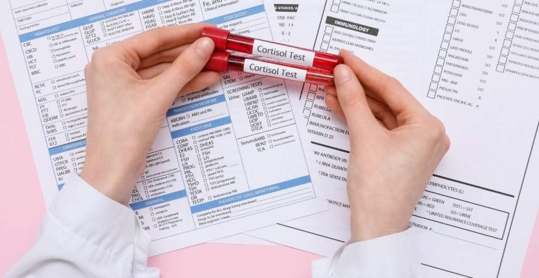 Xét nghiệm nội tiết tố nữ: Chi phí, thời điểm và quy trình chi tiết